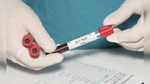 igvte03o_hiv-aids-generic_625x300_23_November_21