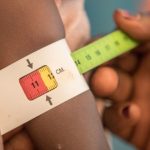 Nigerian Govt Raises Alarm Over ‘Triple Burden’ of Malnutrition