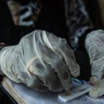 Rwanda Reconsiders Malaria Vaccines Amid Surprise Surge