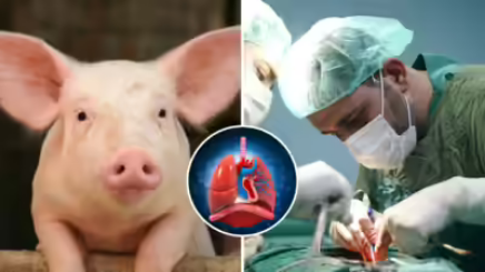 Screenshot 2025-09-03 at 09-48-14 Gene-edited pig lung transplanted into a brain-dead patient for first time - Google Search