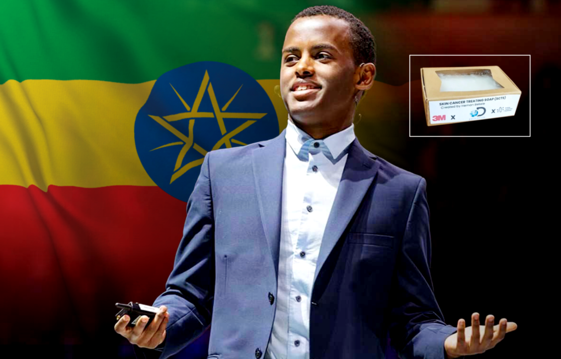Skin Cancer Soap Invented by an Ethiopian-American Teenager