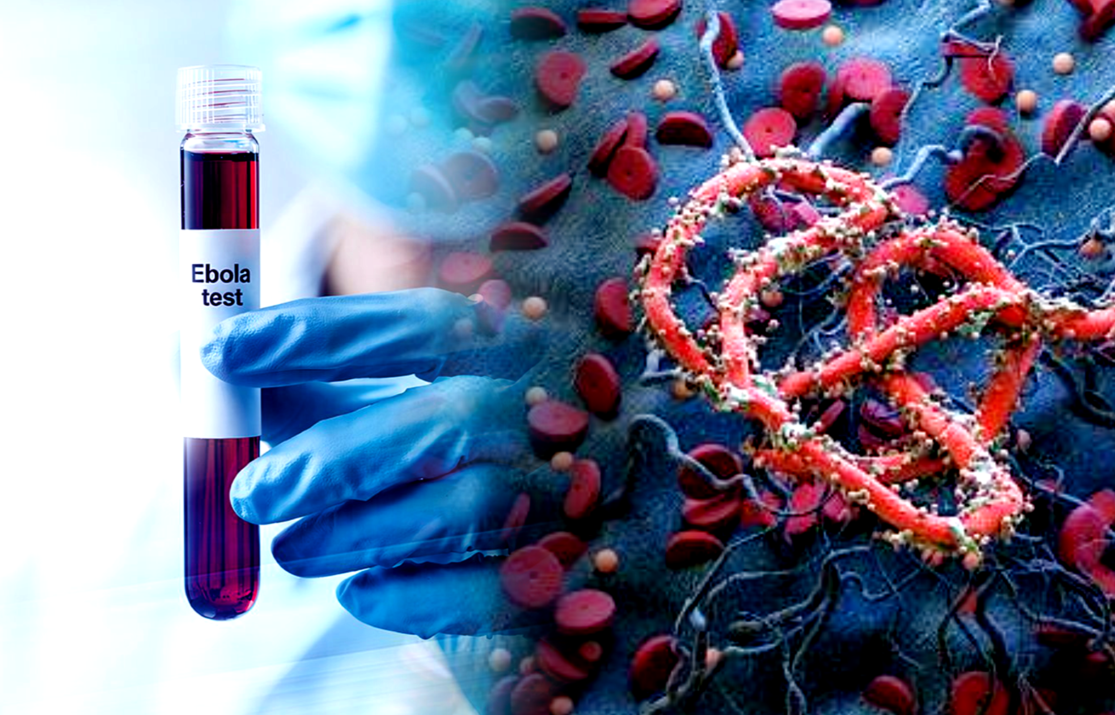 Bundibugyo Virus Disease Outbreak in Democratic Republic of Congo (DRC) and Uganda