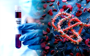 @#drcebola455