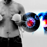 Cancer Catches a Killing-Cruise Daily with Over 26,000 Deaths, according to WHO